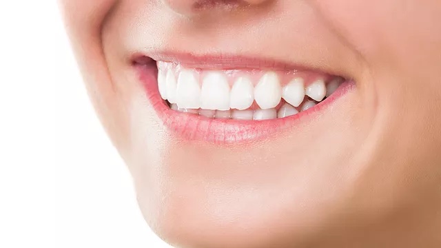 High Gloss Smile